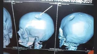 Rahul Gandhi: വോട്ടുകളില്ലാതാക്കാന്‍ ഗൂഢാലോചന നടക്കുന്നു; വോട്ടുകൊള്ളയ്ക്ക് സഹായം ചെയ്യുന്നത് തെരഞ്ഞെടുപ്പ് കമ്മീഷന്‍: രാഹുല്‍ ഗാന്ധി