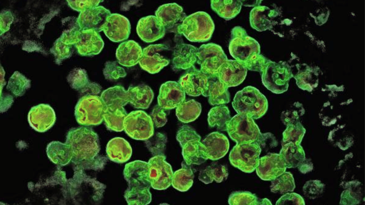 Amoebic Meningitis: അമീബിക് മസ്തിഷ്ക ജ്വരം; ചികിത്സയിലുള്ള 2 പേരുടെ നില ഗുരുതരം, സംസ്ഥാനം ജാഗ്രതയിൽ