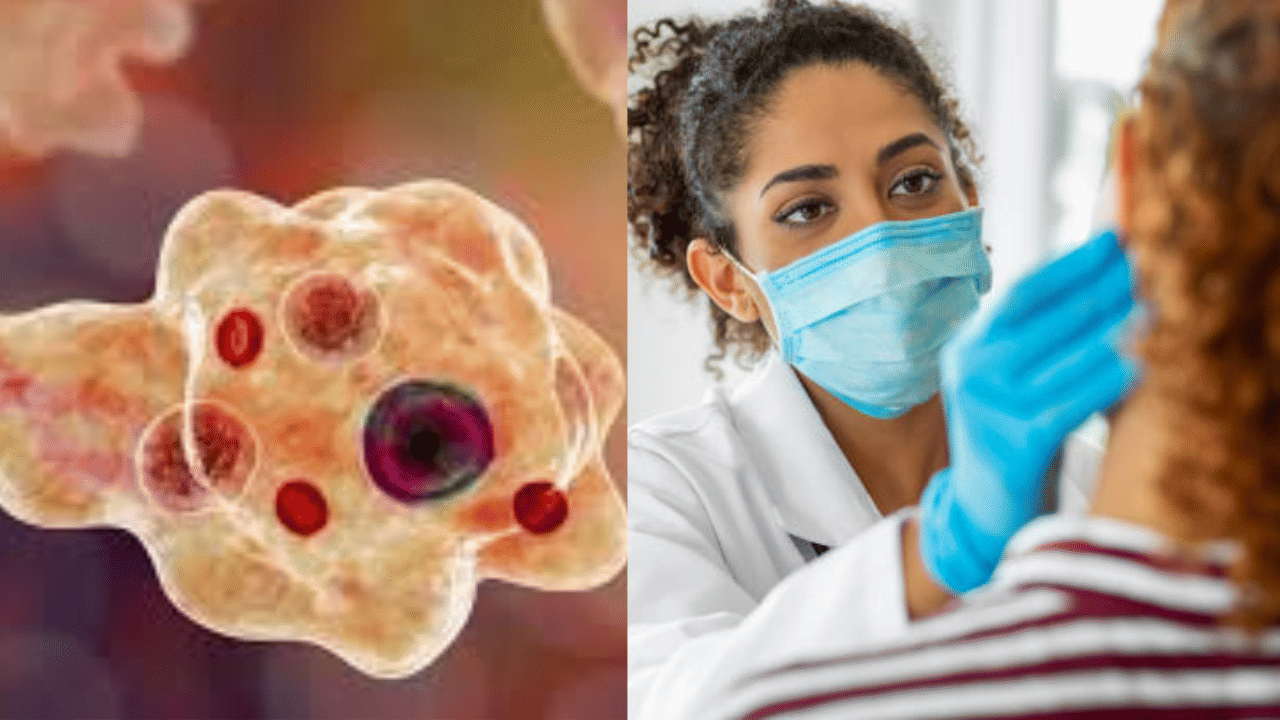 Amoebic Meningoencephalitis: ആശ്വാസം; അമീബിക് മസ്‌തിഷ്‌ക ജ്വരം ബാധിച്ച 11കാരി പൂര്‍ണ ആരോഗ്യവതി; ആശുപത്രിവിട്ടു