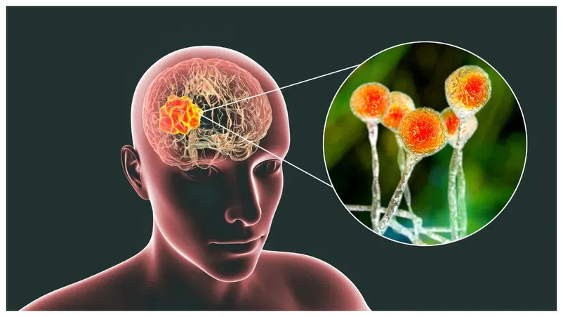 Amoebic Meningoencephalitis: കേരളത്തിലെ കാലാവസ്ഥയും അമീബിക് മസ്തിഷ്കജ്വരവും തമ്മിൽ എന്തു ബന്ധം ?