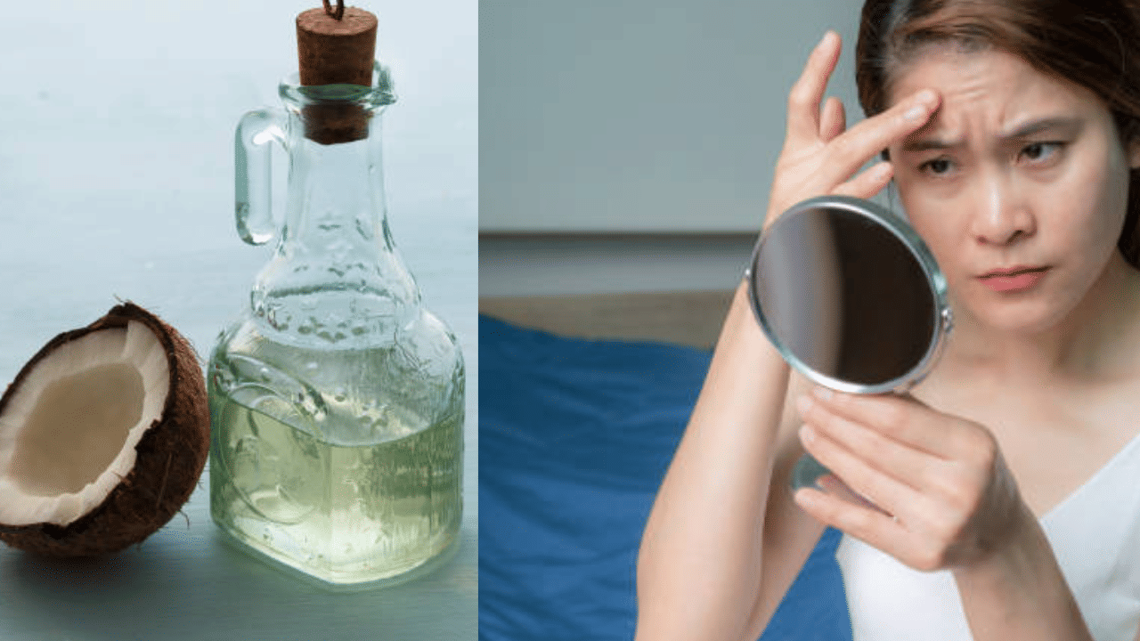 രാത്രി ഉറങ്ങുന്നതിന് മുമ്പ് വെളിച്ചെണ്ണ മോയ്‌സ്ച്യുറൈസറായി ഉപയോഗിക്കാം. രാവിലെ ചെറുചൂടുള്ള വെള്ളവും മൃദുവായ ക്ലെൻസറും ഉപയോഗിച്ച് കഴുകാം. (Image Credit: Getty Images)