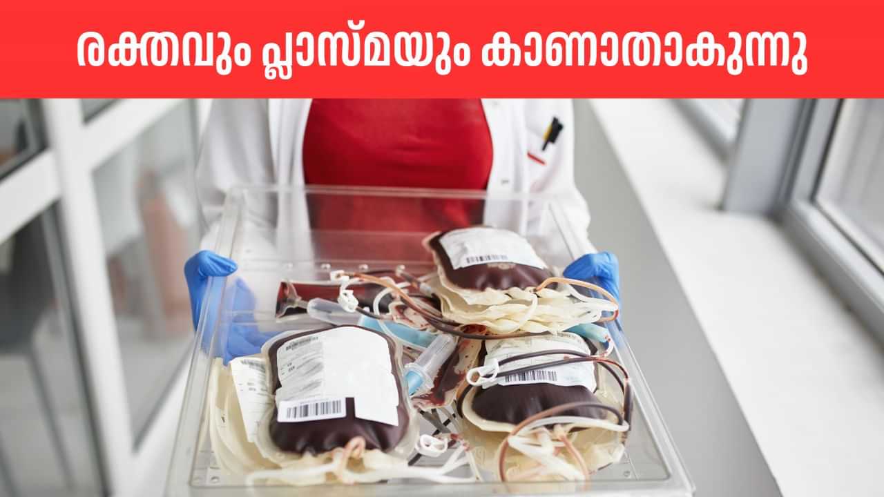 AIIMS Bhopal: എയിംസിൽ നിന്ന് രക്തവും പ്ലാസ്മയും കാണാതാകുന്നു; ജീവനക്കാരനെതിരെ കേസ്