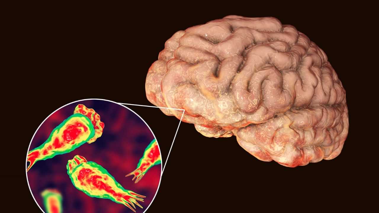 Amoebic Meningitis: അമീബിക് മസ്തിഷ്ക ജ്വര മരണസംഖ്യ ഉയരുന്നു; കൊല്ലം സ്വദേശിനി മരിച്ചു Amoebic Meningitis: അമീബിക് മസ്തിഷ്ക ജ്വര മരണസംഖ്യ ഉയരുന്നു; കൊല്ലം സ്വദേശിനി മരിച്ചു