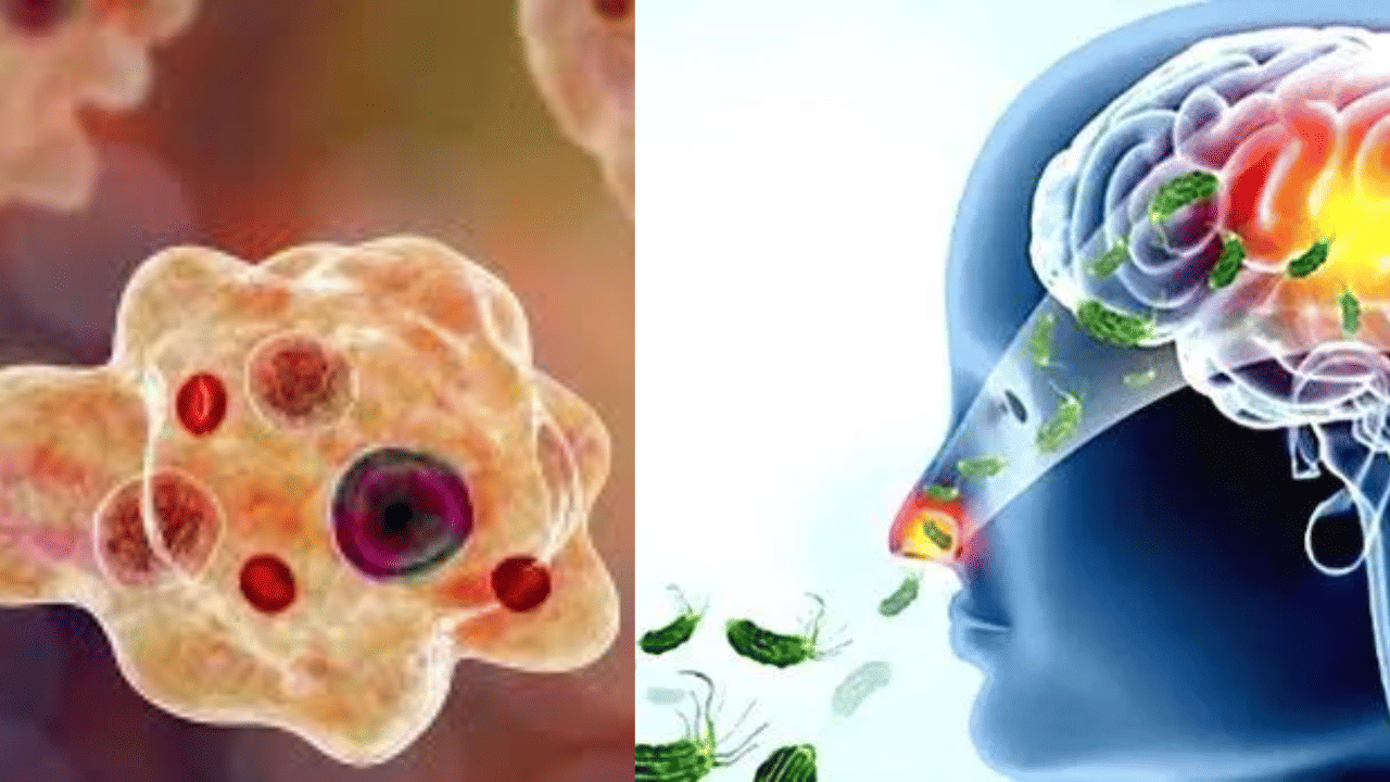 Amoebic Meningoencephalitis: പിടിമുറുക്കി അമീബിക് മസ്തിഷ്കജ്വരം; അഞ്ച് പേർക്ക് കൂടി രോഗബാധ