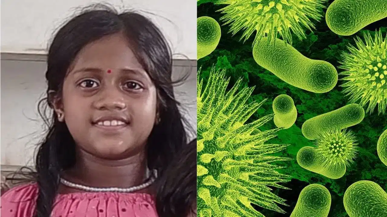 Thamarassery girl death: താമരശ്ശേരി ആശുപത്രി ആക്രമണം: മരണകാരണം അമീബിക് മസ്തിഷ്കജ്വരം അല്ല; പോസ്റ്റ്‌മോർട്ടം റിപ്പോർട്ടിൽ വഴിത്തിരിവ്
