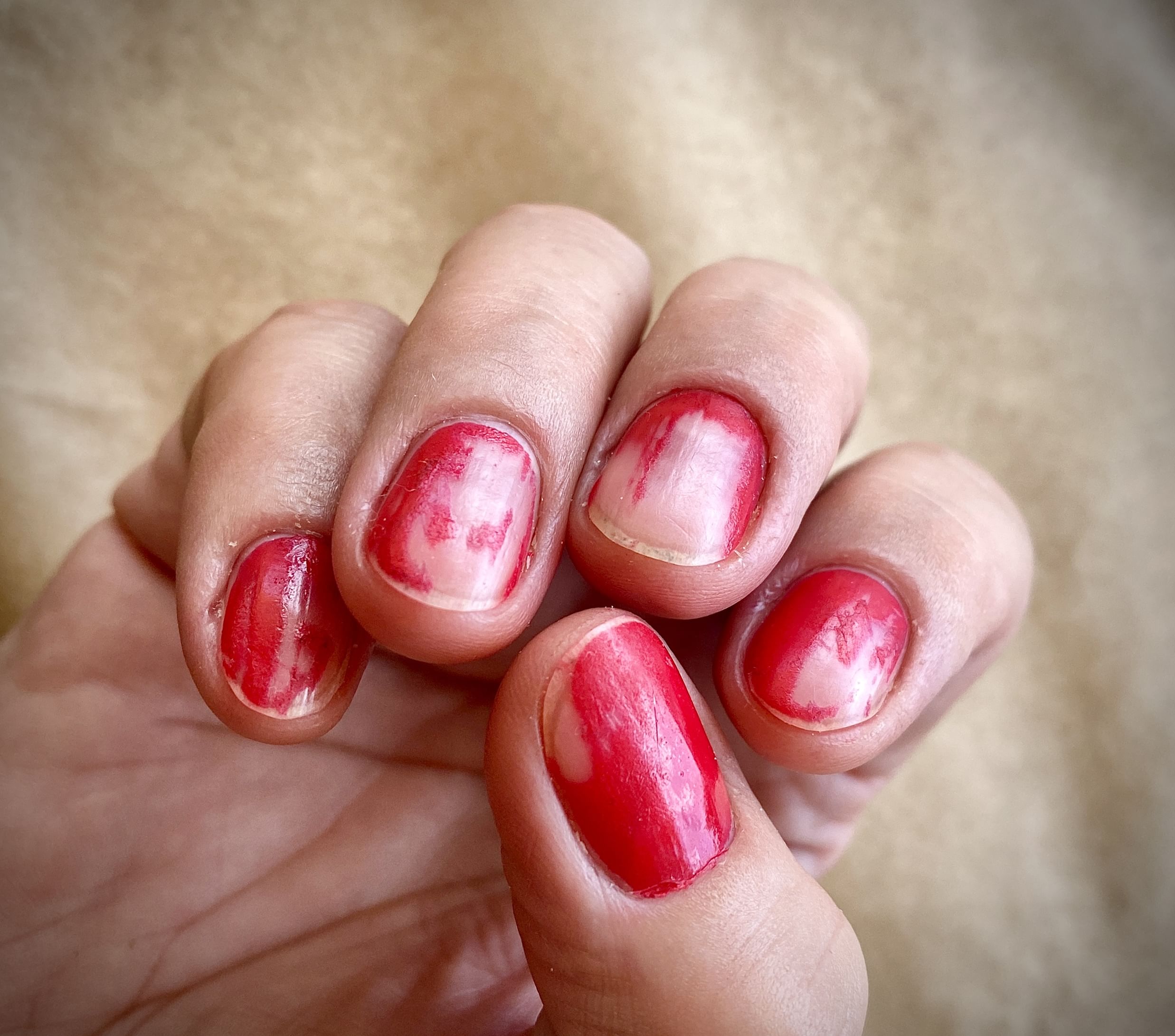 പലരും നേരിടുന്ന പ്രശ്നമാണ് നഖം ഒടുഞ്ഞുപോകുന്നത്. ഇടയ്ക്കിടെ നഖം ഒടിയുന്നതിൻ്റെ കാരണത്തെപ്പറ്റി നിങ്ങൾ എപ്പോഴെങ്കിൽ അന്വേഷിച്ചിട്ടുണ്ടോ? നിസാരമായി കാണുന്ന ഇവ പലപ്പോഴും ആരോഗ്യപരമായ മോശം അവസ്ഥയെ സൂചിപ്പിക്കുന്നു. വീട്ടുജോലികളിൽ ഏർപ്പെടുന്നത് മുതൽ നഖം കടിക്കുന്നത് വരെ ഇതിന് പിന്നിലെ കാരണങ്ങളാണ്. എന്നാൽ ഇവയെ എങ്ങനെ തടയാമെന്ന് നോക്കാം. (Image Credits: Getty Images)