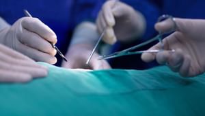 Kerala Medical Error: ഹെർണിയ ശസ്ത്രക്രിയയ്ക്കിടെ പിഴവ്; രോഗി മരിച്ചു, അബദ്ധം പറ്റിയെന്ന് ഡോക്ടർ Kerala Medical Error: ഹെർണിയ ശസ്ത്രക്രിയയ്ക്കിടെ പിഴവ്; രോഗി മരിച്ചു, അബദ്ധം പറ്റിയെന്ന് ഡോക്ടർ