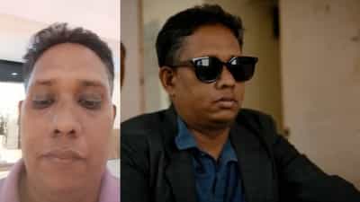 Santhosh Varkey: കാൻസറിന്റെ പേരിൽ പണപ്പിരിവും? വിവാദച്ചുഴിയിൽ ആറാട്ടണ്ണൻ! ഞെട്ടിക്കുന്ന വെളിപ്പെടുത്തലുകൾ!