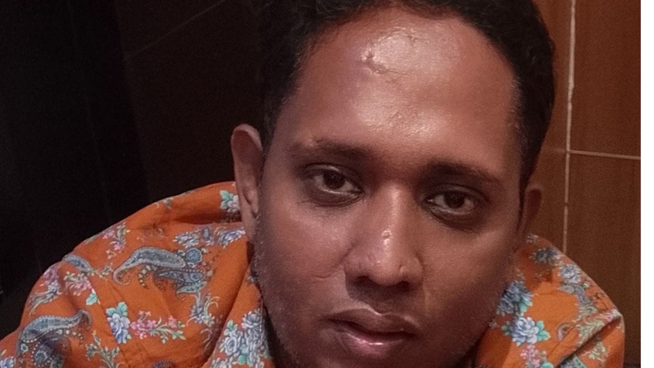 തനിക്ക് മള്‍ട്ടിപ്പിള്‍ മൈലോമയാണ്. ഇതിന് മരുന്നില്ലാ എന്നൊക്കെ തുടരെ പോസറ്റുകളുമായി ആറാട്ടണ്ണൻ എത്തി. തന്റെ പിതാവിനും ഇതേ രോഗമായിരുന്നു. ജീവിതത്തില്‍ ഒരുപാട് അനുഭവിച്ചു. മരിച്ചുപോയ പിതാവിനെക്കുറിച്ച് മോശമായി പറഞ്ഞതാണ് ഏറ്റവും കൂടുതൽ വേദനിച്ചത്.(photo credit: santhosh varket/social media)