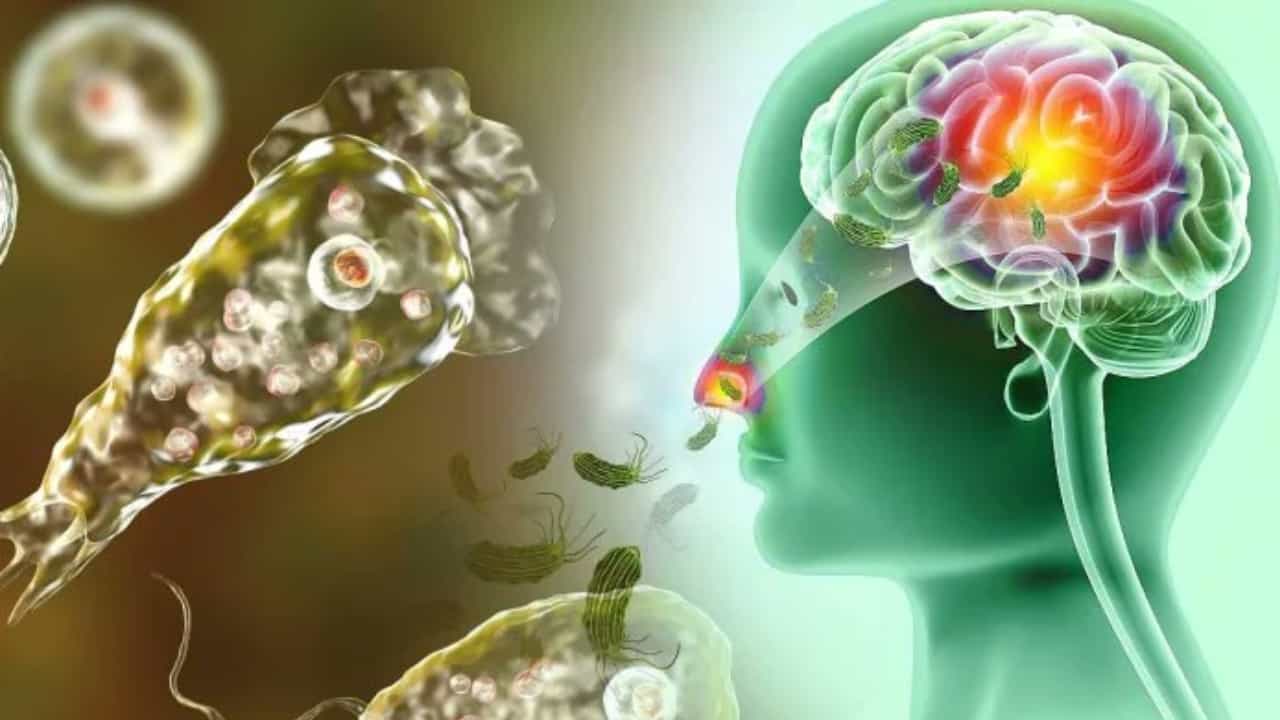 Amoebic Meningoencephalitis: തിരൂർ സ്വദേശിയായ 78കാരന് അമീബിക് മസ്തിഷ്കജ്വരം സ്ഥിരീകരിച്ചു; നില ഗുരുതരമെന്ന് ആശുപത്രി അധികൃതർ