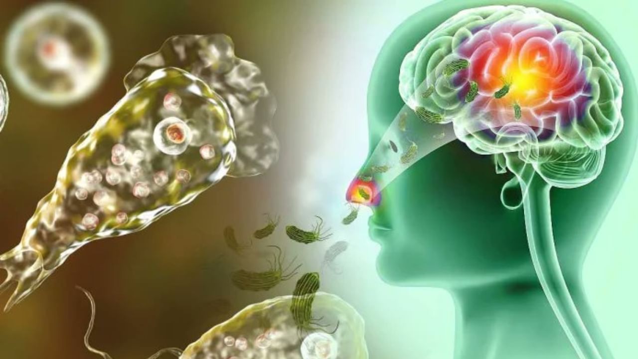 Amoebic Meningoencephalitis: തിരൂർ സ്വദേശിയായ 78കാരന് അമീബിക് മസ്തിഷ്കജ്വരം സ്ഥിരീകരിച്ചു; നില ഗുരുതരമെന്ന് ആശുപത്രി അധികൃതർ