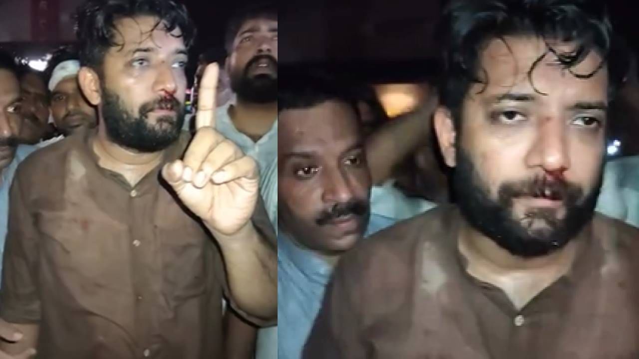 Perambra CLash: എൽഡിഎഫ്–യുഡിഎഫ് പ്രകടനങ്ങൾക്കിടെ ലാത്തിച്ചാര്‍ജ്; ഷാഫി പറമ്പിൽ എംപിക്ക് പരിക്ക്; സെക്രട്ടറിയേറ്റിലേക്ക് മാർച്ച്