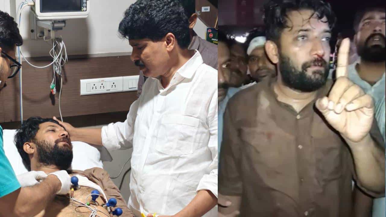 Perambra CLash: ഷാഫി പറമ്പിലിന്റെ മൂക്കിനു പൊട്ടൽ; അടിയന്തിര ശാസ്ത്രക്രിയക്ക് വിധേയനാക്കി