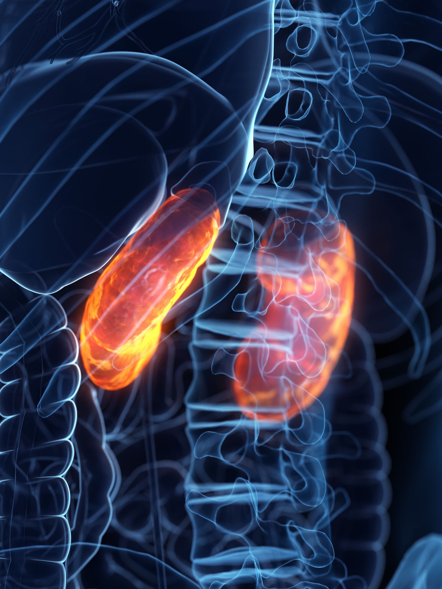 ക്രോണിക് കിഡ്‌നി ഡിസീസ്: രക്തത്തിൽ നിന്ന് മാലിന്യങ്ങളും അധിക ദ്രാവകങ്ങളും ഫിൽട്ടർ ചെയ്യുന്ന പ്രക്രിയയാണ് വൃക്കകളുടേത്. ക്രോണിക് കിഡ്‌നി ഡിസീസ് സംഭവിക്കുമ്പോൾ, നെഫ്രോണുകൾ എന്നറിയപ്പെടുന്ന ചെറിയ ഫിൽട്ടറിംഗ് യൂണിറ്റുകൾക്ക് കേടുപാടുകൾ സംഭവിക്കുകയും, ഈ ഫിൽട്ടറിംഗ് പ്രക്രിയ തകരാറിലാകുകയും ചെയ്യുന്നു. ഇതേ തുടർന്ന് രക്തത്തിൽ വിഷവസ്തുക്കൾ അടിഞ്ഞുകൂടുകയും ഹൃദയാരോ​ഗ്യം വരെ മോശമായേക്കാം. (Image Credits: Getty Images)
