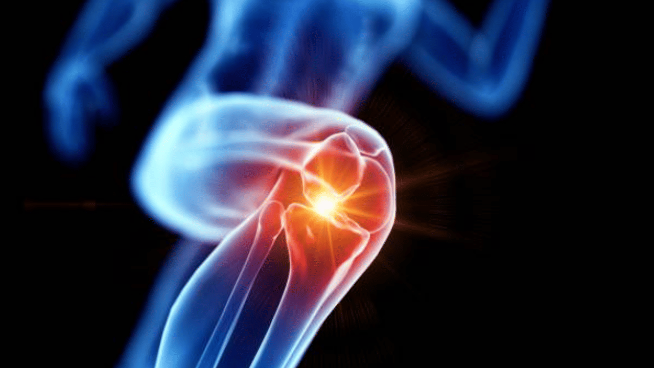 Bone Health: മുപ്പത് കഴിഞ്ഞോ? എല്ലിന്റെ ബലം കൂട്ടാൻ ഇതൊന്ന് ചെയ്താൽ മതി