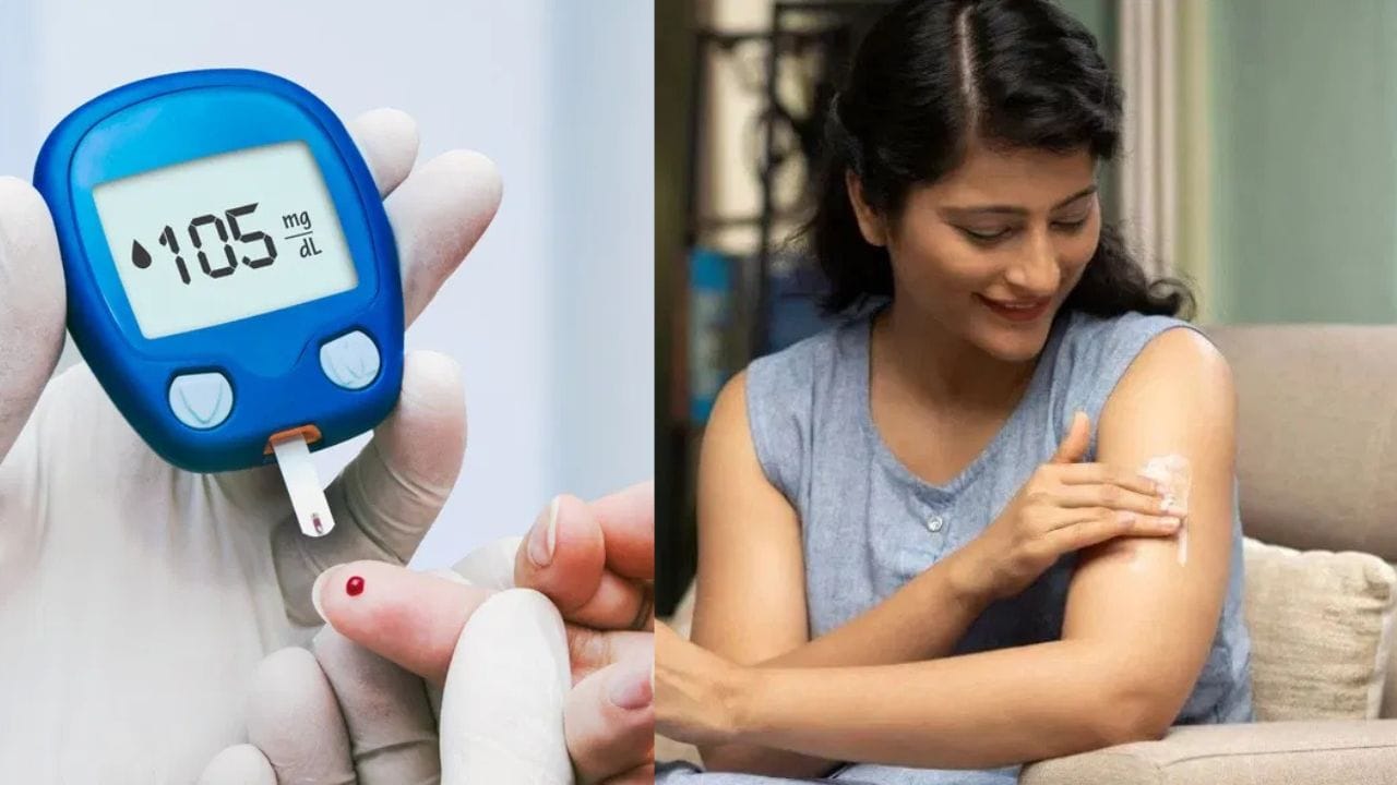 Diabetes treatment : പ്രമേഹരോ​ഗികളോടാണ്… ഇൻജെക്ഷൻ വേണ്ട, സ്കിൻക്രീം പുരട്ടും പോലെ ഇൻസുലിൻ സപ്ലൈ നടക്കും