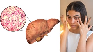 Turmeric: ചർമപ്രശ്നങ്ങൾക്ക് പലതരം മരുന്ന് വേണ്ട, വീട്ടിലുള്ള ഈ ഒരൊറ്റ സാധനം മതി