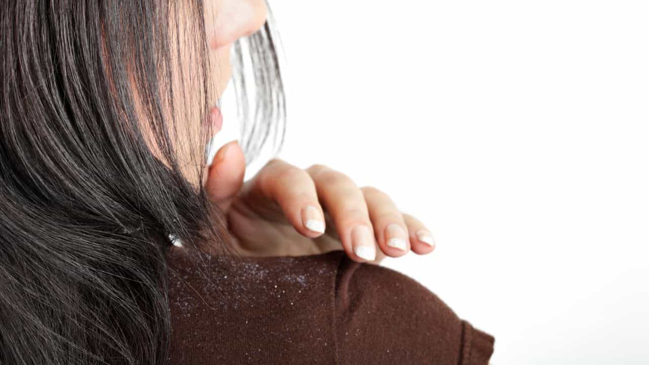 Haircare Tips And Tricks: ശുചിത്വമില്ലായ്മ മാത്രമാണോ താരന് കാരണം; ഈ ദുശീലങ്ങളും നിങ്ങളുടെ മുടിയിഴകളെ...