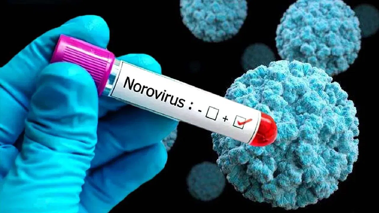 Norovirus: ആഢംബര കപ്പലിൽ നോറോ വൈറസ്: 100-ൽ അധികം പേർക്ക് രോഗബാധ, രോഗവ്യാപനത്തിന്റെ കാരണമിതാ…