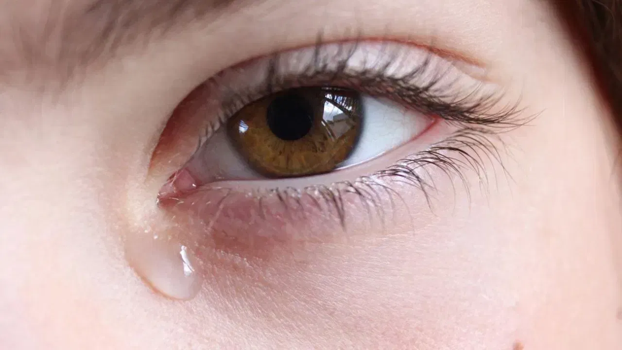 കണ്ണുകളുടെ ആരോഗ്യം സംരക്ഷിക്കാൻ പുറത്തുപോകുമ്പോൾ ഗോഗിൾസുകളോ സംരക്ഷിത കണ്ണടകളോ ഉപയോഗിക്കുക. പ്രസർവേറ്റീവ് രഹിതമായ കൃത്രിമ കണ്ണീർ ഉപയോഗിച്ച് കണ്ണുകൾ ഈർപ്പമുള്ളതാക്കുന്നതും ഒരു പ്രതിരോധമാണ്. ഓരോ 20 മിനിറ്റിലും, 20 അടി അകലെയുള്ള വസ്തുവിലേക്ക് 20 സെക്കൻഡ് നോക്കി കണ്ണിന് വിശ്രമം നൽകുന്നതണ് മറ്റൊരു വഴി. വിറ്റാമിൻ A, C, E, ഒമേഗ-3 ഫാറ്റി ആസിഡുകൾ എന്നിവ അടങ്ങിയ ഭക്ഷണം ശീലമാക്കുന്നതാണ് മറ്റൊന്ന്.