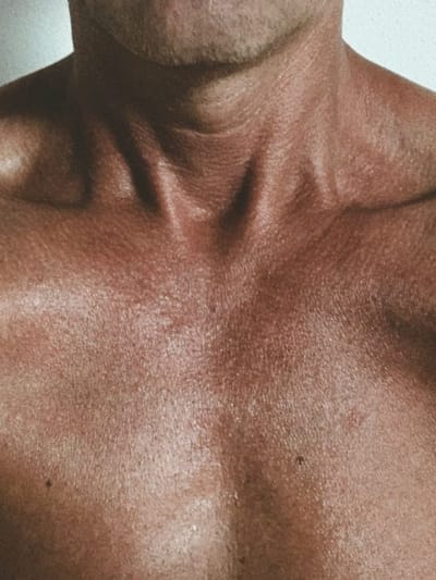 ചർമ്മത്തിലെ ഈ മാറ്റങ്ങൾ തൈറോയിഡിന്റേയോ?