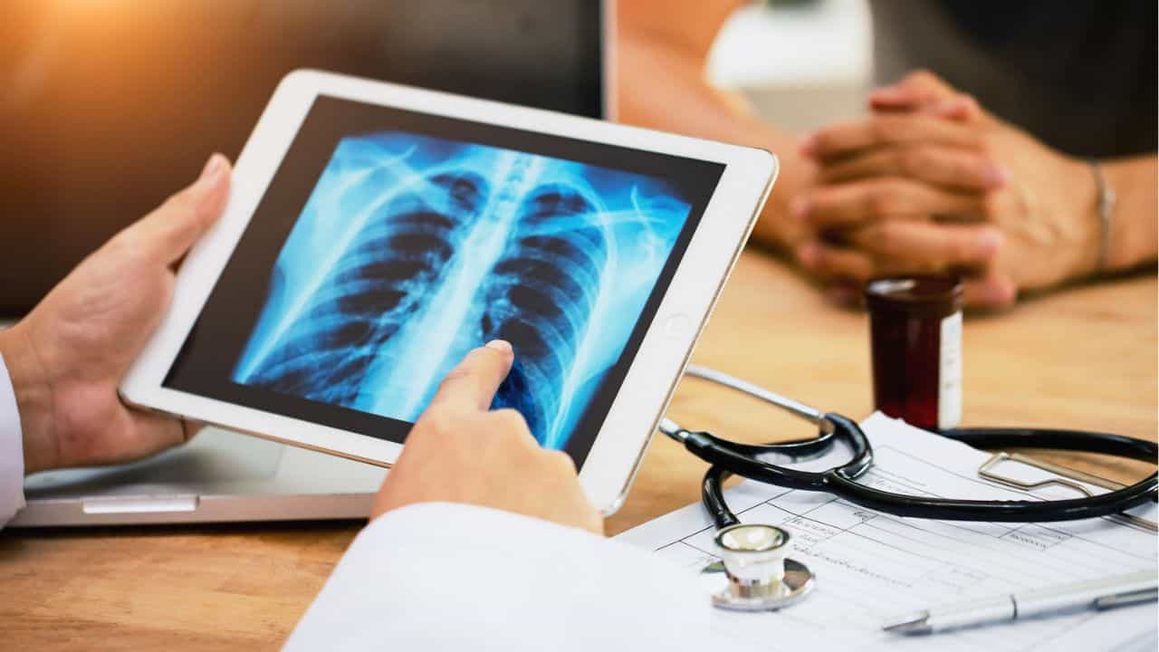 Lung Cancer: ആദ്യ ലക്ഷണം ചുമ, പുകവലിക്കാത്തവരും ശ്രദ്ധിക്കണം; ശ്വാസകോശ അർബുദത്തിന്റെ തുടക്കം