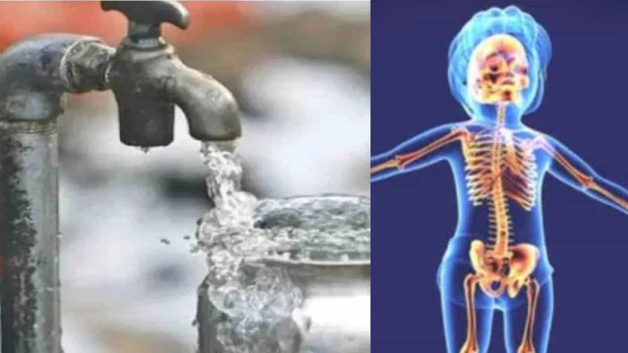 Alappuzha Fluorosis: എല്ലിനും പല്ലിനും പ്രശ്നം, പുരുഷന്മാർക്ക് വന്ധ്യത, കുടിവെള്ളത്തെ ഭയക്കേണ്ട അവസ്ഥ, ആലപ്പുഴയിൽ പിടിമുറുക്കി പുതിയ രോഗം Alappuzha Fluorosis: എല്ലിനും പല്ലിനും പ്രശ്നം, പുരുഷന്മാർക്ക് വന്ധ്യത, കുടിവെള്ളത്തെ ഭയക്കേണ്ട അവസ്ഥ, ആലപ്പുഴയിൽ പിടിമുറുക്കി പുതിയ രോഗം