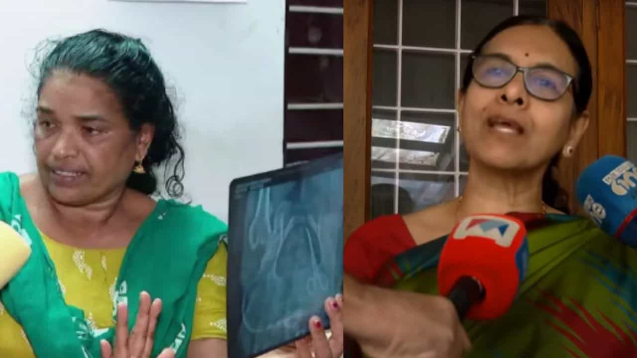 Scissors in Stomach: കത്രിക 50 കൊല്ലം ഇരുന്നാലും സേഫ് ആണ് സേഫ്... രോഗി ഇത്ര കാലം എവിടെയായിരുന്നു? വിചിത്ര ന്യായീകരണവുമായി ഡോക്ടർ