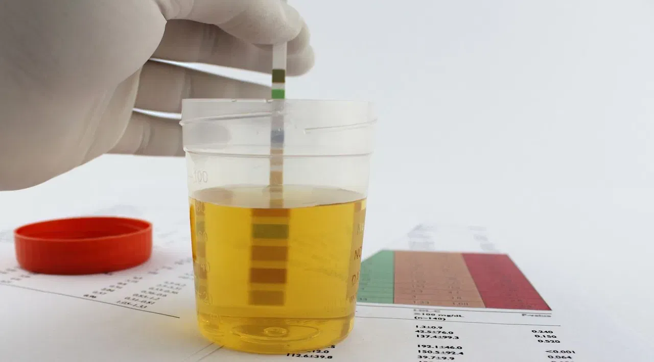 ലളിതമായ ഒരു യൂറിൻ ടെസ്റ്റിലൂടെ വൃക്കരോഗങ്ങൾ മാത്രമല്ല, മൂത്രാശയ കാൻസർ വരെ നേരത്തെ തിരിച്ചറിയാൻ സാധിക്കും. അതിനാൽ മാറ്റങ്ങൾ കണ്ടാൽ ഉടൻ ഡോക്ടറെ കാണുക.