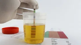 നിങ്ങളുടെ വൃക്ക പെർഫെക്ടാണോ? മൂത്രം നോക്കി മനസ്സിലാക്കേണ്ടത്...