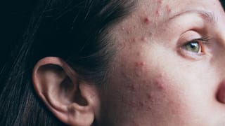 Oshana 2026: ഓശാന സ്പെഷ്യൽ കൊഴുക്കട്ട ഉണ്ടാക്കിയാലോ, റെസിപ്പി ഇതാ