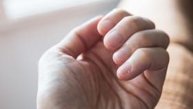 നഖങ്ങളിൽ തവിട്ട് വരയുണ്ടോ? അവ​ഗണിക്കരുത്; ഈ രോ​ഗത്തിൻ്റെ ലക്ഷണമാക