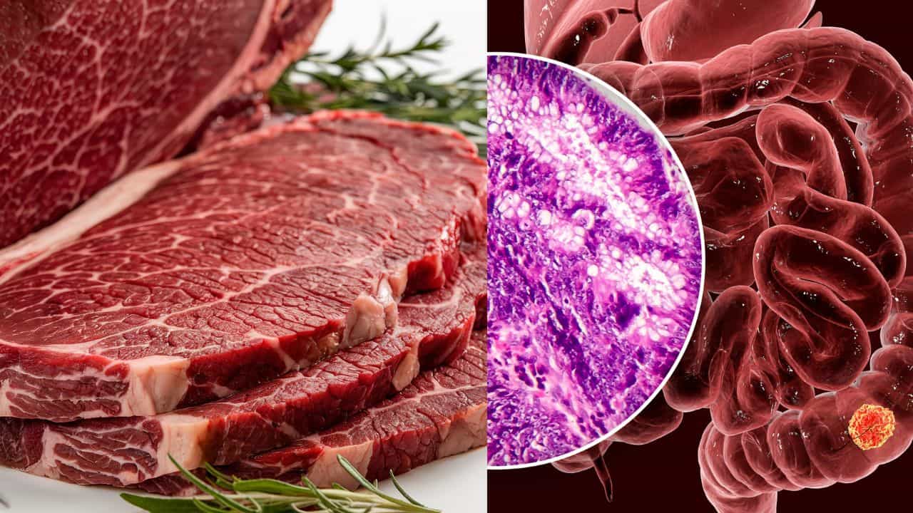 Colon Cancer: പ്ലേറ്റിലുള്ളത് കാൻസറിന് കാരണമാകുമോ? വൻകുടൽ കാൻസർ വിളിച്ചുവരുത്തുന്ന ഈ ഭക്ഷണങ്ങൾ ഒഴിവാക്കൂ Colon Cancer: പ്ലേറ്റിലുള്ളത് കാൻസറിന് കാരണമാകുമോ? വൻകുടൽ കാൻസർ വിളിച്ചുവരുത്തുന്ന ഈ ഭക്ഷണങ്ങൾ ഒഴിവാക്കൂ