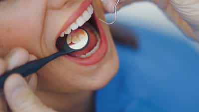 Teeth Health: വായ്നാറ്റം മുതൽ മോണവീക്കം വരെ; പല്ലുകൾ കാണിക്കുന്ന ഈ ലക്ഷണങ്ങൾ അവ​ഗണിക്കരുത്