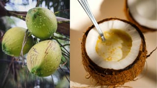 Mumps Treatment: ഈ ലക്ഷണങ്ങൾ കുട്ടികളിൽ ഉണ്ടോ? എങ്കിൽ ശ്രദ്ധിക്കുക… മുണ്ടിനീര് അത്ര നിസ്സാര രോ​ഗമല്ല