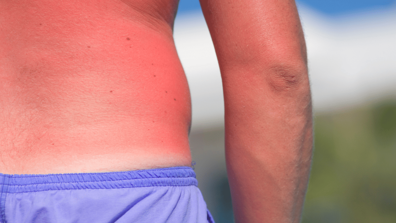 തണ്ണിമത്തൻ, വെള്ളരിക്ക എന്നിവ കഴിക്കുന്നത് ശരീരം തണുക്കാൻ നിങ്ങളെ സഹായിക്കുന്നതാണ്, ധാരാളം വെള്ളം കുടിക്കാനും മറക്കരുത്.