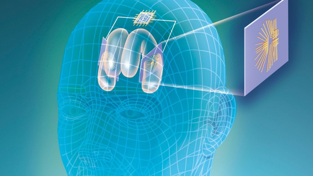 Brain - Computer Interface: എലോൺ മസ്കിൻ്റെ ന്യൂറോലിങ്കിന് എന്ത് ...