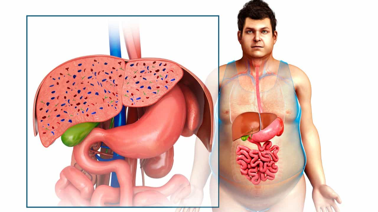 Fatty Liver Symptoms: ശരീരം തരുന്ന ഈ സൂചനകൾ അവഗണിക്കല്ലേ; ഫാറ്റി ലിവർ തിരിച്ചറിയാൻ ഇതാ വഴികൾ Fatty Liver Symptoms: ശരീരം തരുന്ന ഈ സൂചനകൾ അവഗണിക്കല്ലേ; ഫാറ്റി ലിവർ തിരിച്ചറിയാൻ ഇതാ വഴികൾ