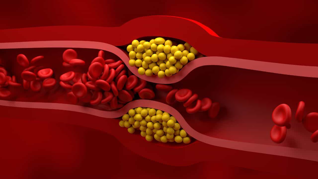 Cholesterol: കൊളസ്ട്രോൾ പേടി വേണ്ട; മരുന്നില്ലാതെ കുറയ്ക്കാൻ സഹായിക്കുന്ന എളുപ്പവഴികൾ ഇതാ! Cholesterol: കൊളസ്ട്രോൾ പേടി വേണ്ട; മരുന്നില്ലാതെ കുറയ്ക്കാൻ സഹായിക്കുന്ന എളുപ്പവഴികൾ ഇതാ!