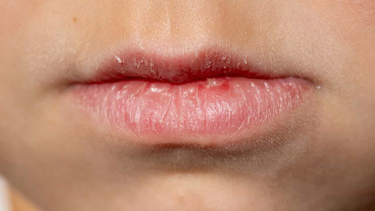 Lips Care: ചുണ്ട് വരണ്ട് പൊട്ടാറുണ്ടോ? പരിഹാരം വീട്ടിൽ തന്നെയുണ്ട് Lips Care: ചുണ്ട് വരണ്ട് പൊട്ടാറുണ്ടോ? പരിഹാരം വീട്ടിൽ തന്നെയുണ്ട്