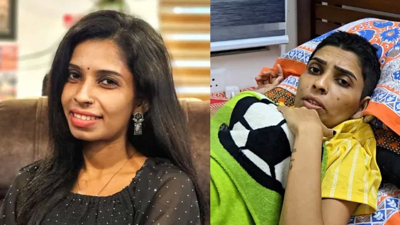Renu Sudhi: ഐസിയുവിൽ! രേണു സുധിയുടെ നില ഗുരുതരം, പ്ലേറ്റ്ലെറ്റുകൾ കുറഞ്ഞു Renu Sudhi: ഐസിയുവിൽ! രേണു സുധിയുടെ നില ഗുരുതരം, പ്ലേറ്റ്ലെറ്റുകൾ കുറഞ്ഞു