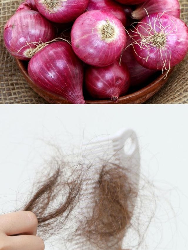 സവാള നീര് തലയിൽ പുരട്ടിയാൽ മുടി വളരുമോ?